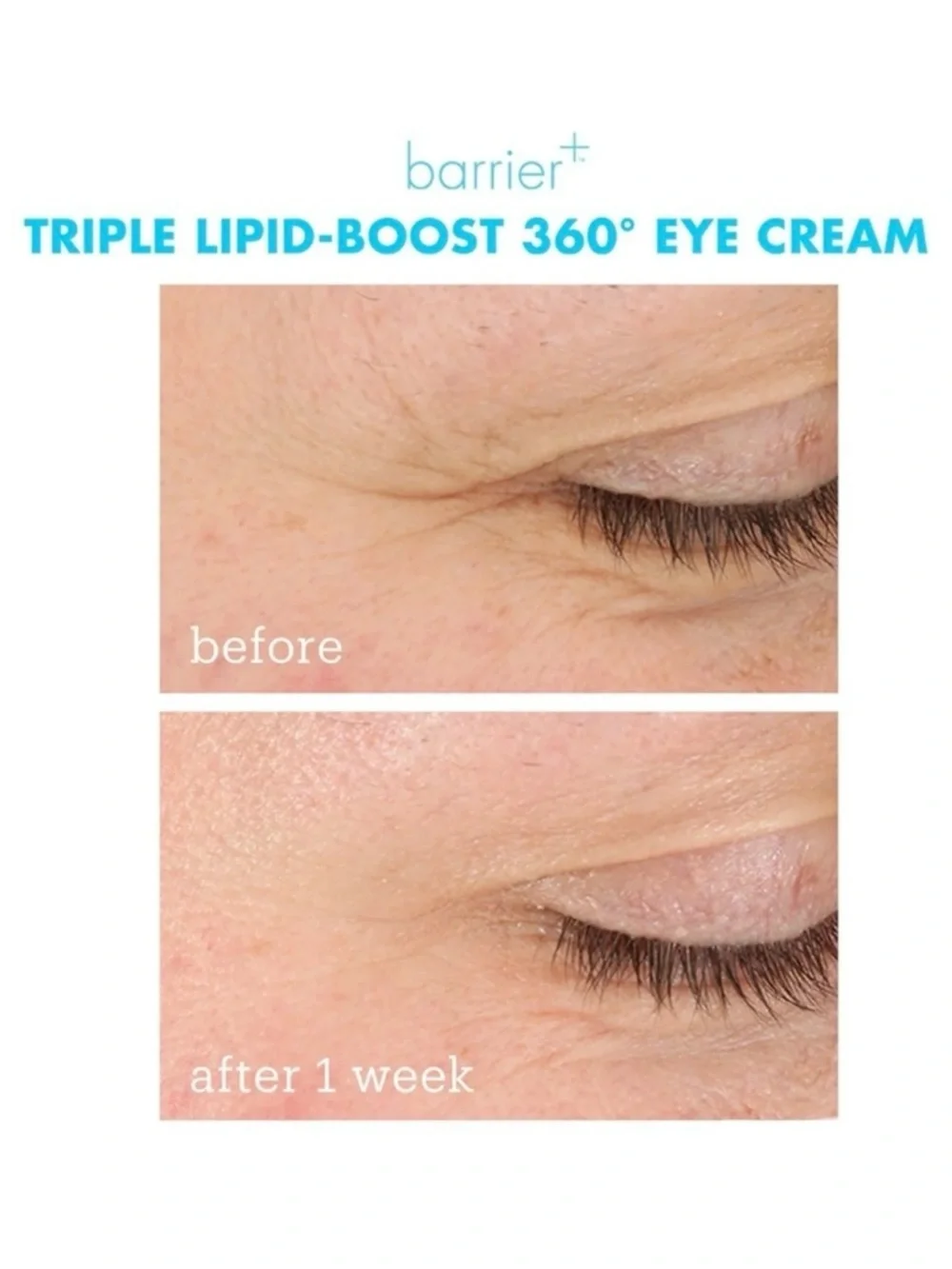 SkinFix Barrier Triple Lipid Boost 360 Eye Moisturizing Eye Cream .5oz